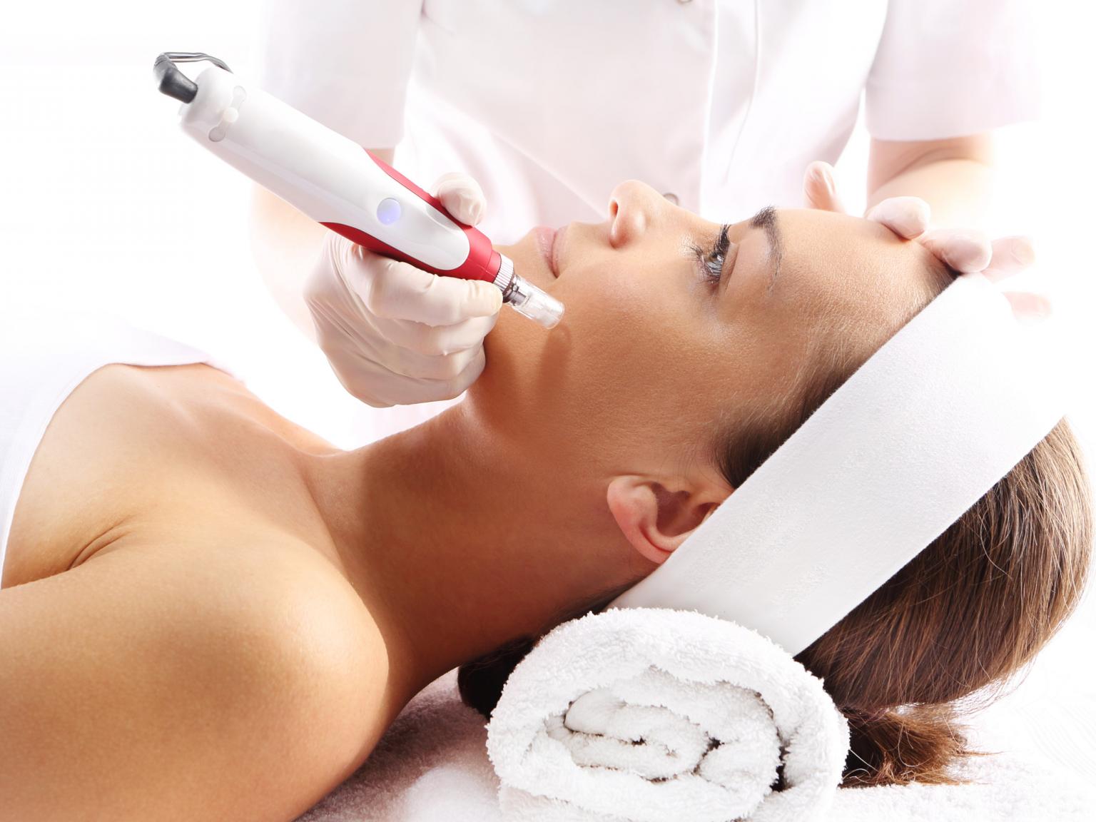 Microneedling